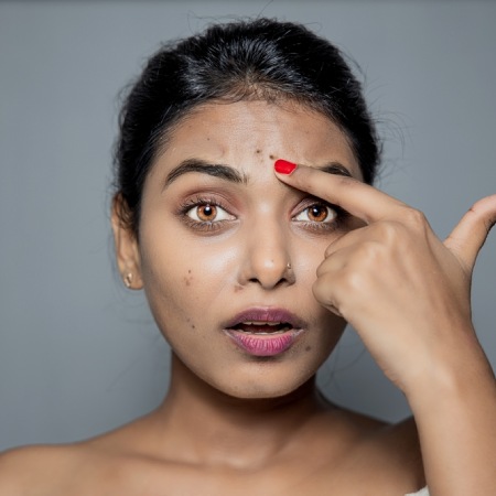 Pigmentation